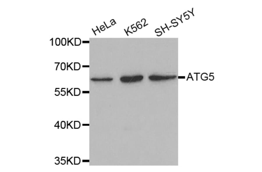 Western blot - ATG5 antibody from Signalway Antibody (39202) - Antibodies.com