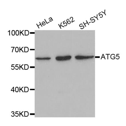 Western blot - ATG5 antibody from Signalway Antibody (39202) - Antibodies.com