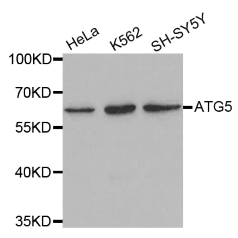 Western blot - ATG5 antibody from Signalway Antibody (39202) - Antibodies.com