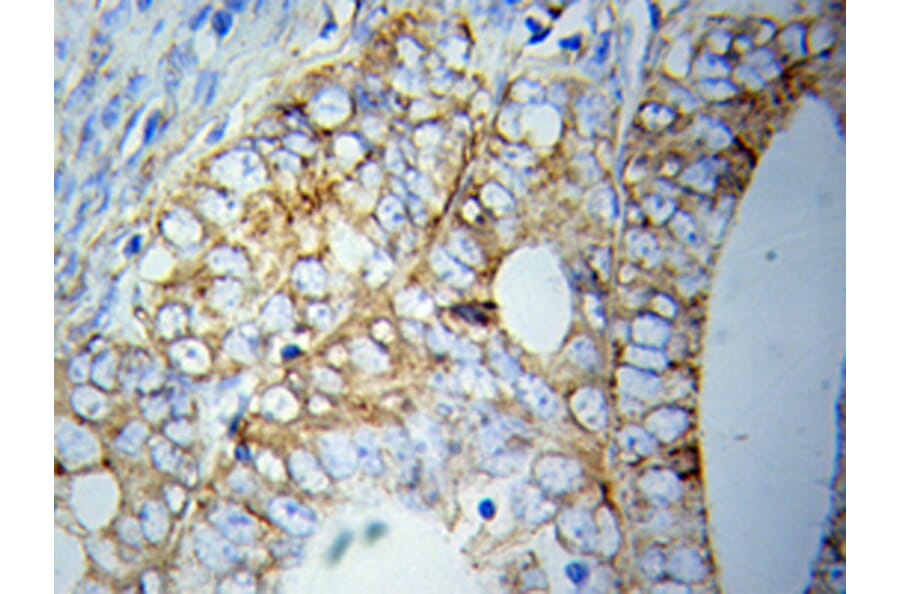 Immunohistochemistry - ATG5 antibody from Signalway Antibody (39202) - Antibodies.com
