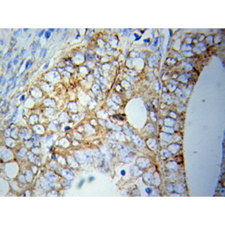 Immunohistochemistry - ATG5 antibody from Signalway Antibody (39202) - Antibodies.com