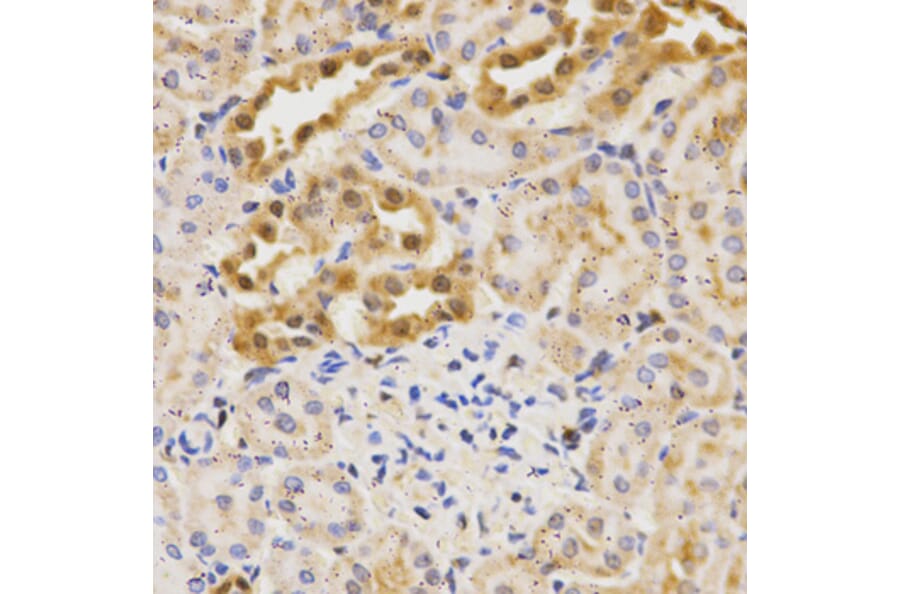 Immunohistochemistry - ATG5 antibody from Signalway Antibody (39202) - Antibodies.com
