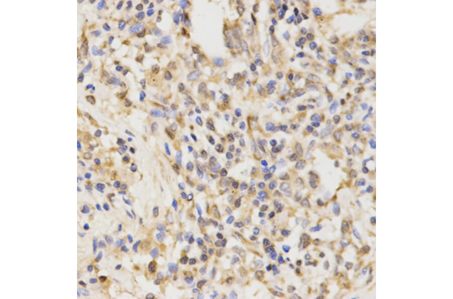 Immunohistochemistry - ATG5 antibody from Signalway Antibody (39202) - Antibodies.com