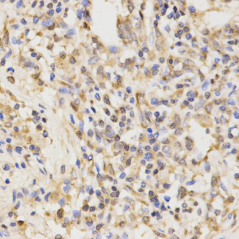 Immunohistochemistry - ATG5 antibody from Signalway Antibody (39202) - Antibodies.com