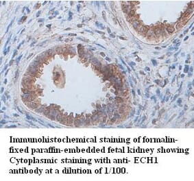 ECH1 Antibody from Signalway Antibody (39397) - Antibodies.com