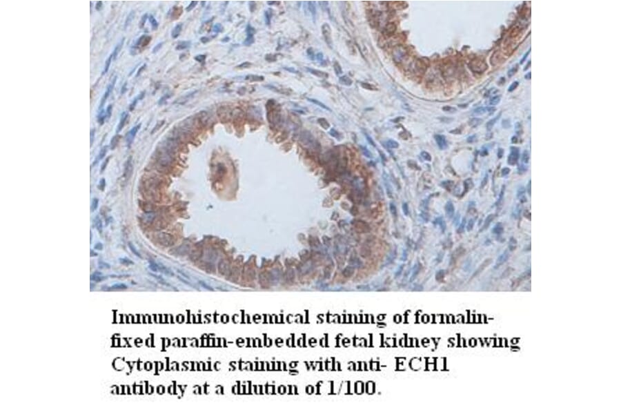 ECH1 Antibody from Signalway Antibody (39397) - Antibodies.com