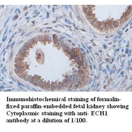 ECH1 Antibody from Signalway Antibody (39397) - Antibodies.com