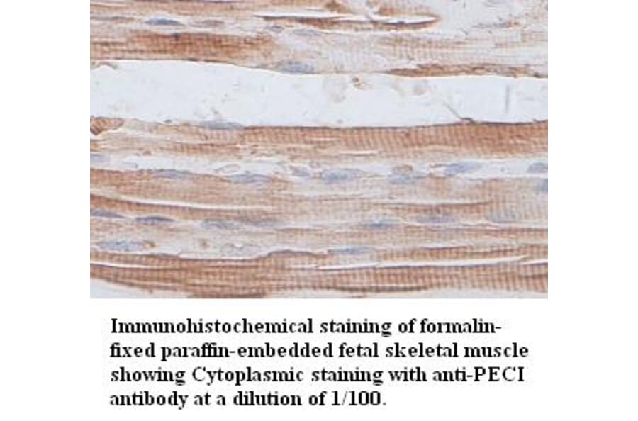 PECI Antibody from Signalway Antibody (39399) - Antibodies.com