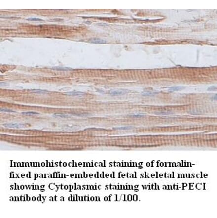 PECI Antibody from Signalway Antibody (39399) - Antibodies.com