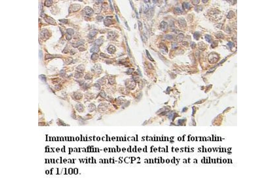 SCP2 Antibody from Signalway Antibody (39403) - Antibodies.com
