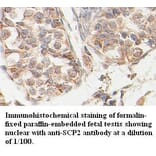SCP2 Antibody from Signalway Antibody (39403) - Antibodies.com