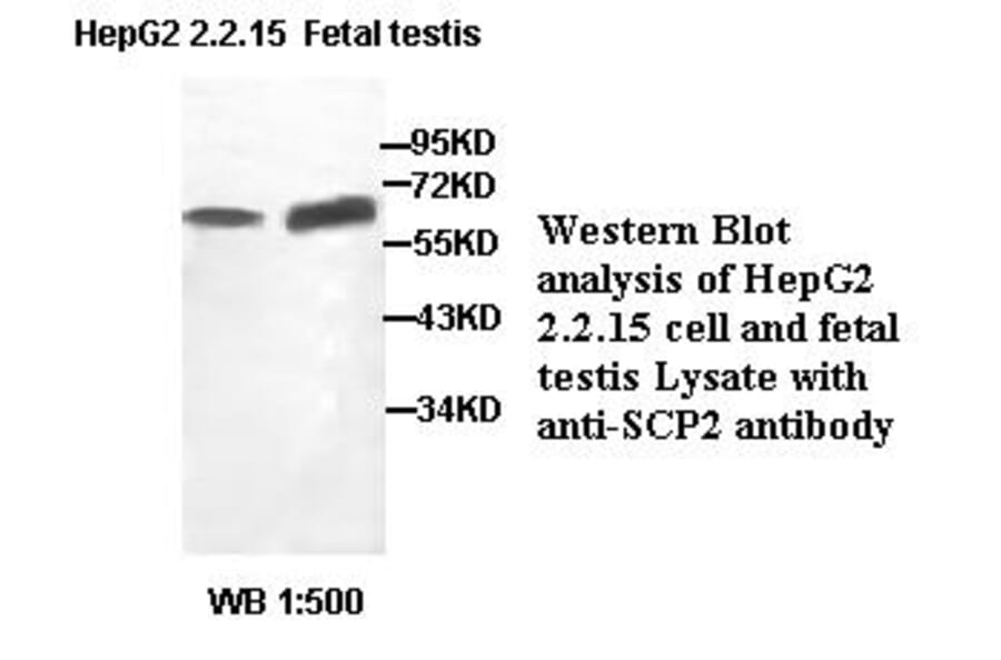 SCP2 Antibody from Signalway Antibody (39403) - Antibodies.com