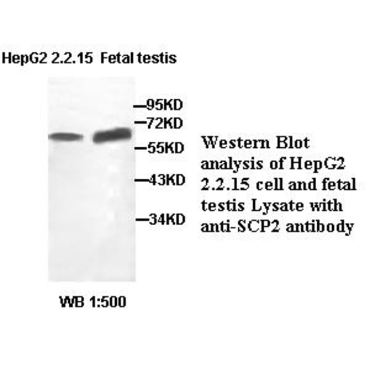 SCP2 Antibody from Signalway Antibody (39403) - Antibodies.com
