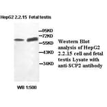 SCP2 Antibody from Signalway Antibody (39403) - Antibodies.com