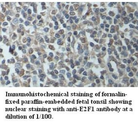 E2F1 Antibody from Signalway Antibody (39415) - Antibodies.com