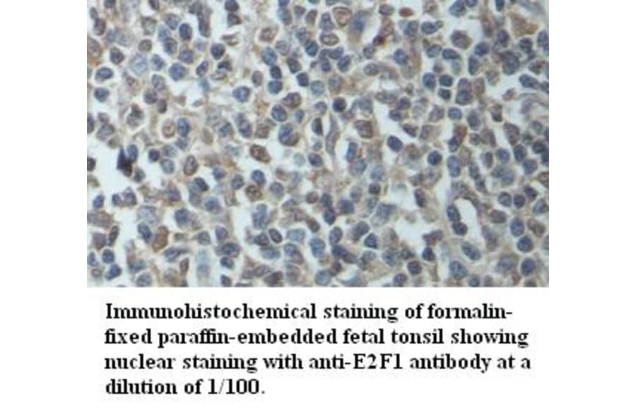 E2F1 Antibody from Signalway Antibody (39415) - Antibodies.com