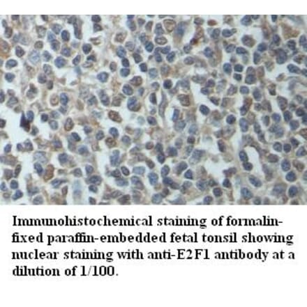 E2F1 Antibody from Signalway Antibody (39415) - Antibodies.com