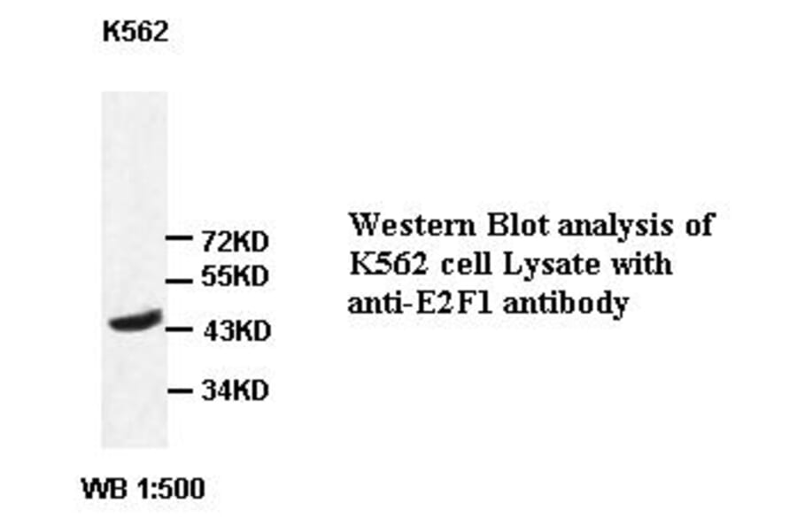 E2F1 Antibody from Signalway Antibody (39415) - Antibodies.com