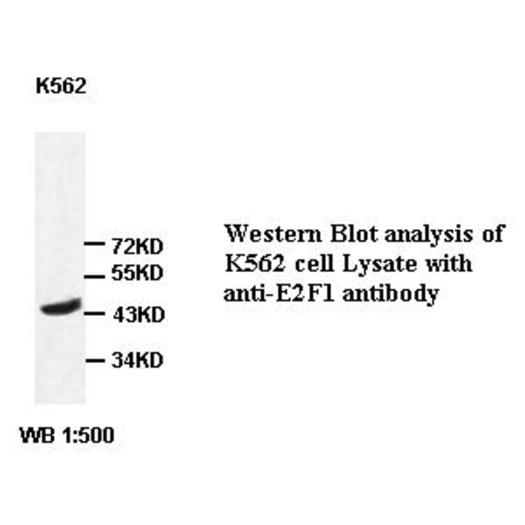E2F1 Antibody from Signalway Antibody (39415) - Antibodies.com