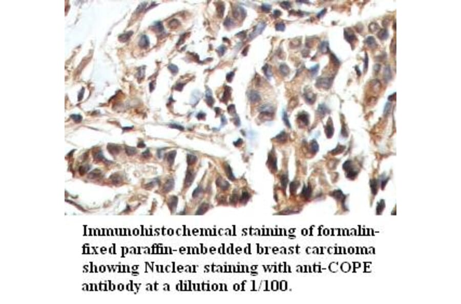 COPE Antibody from Signalway Antibody (39423) - Antibodies.com