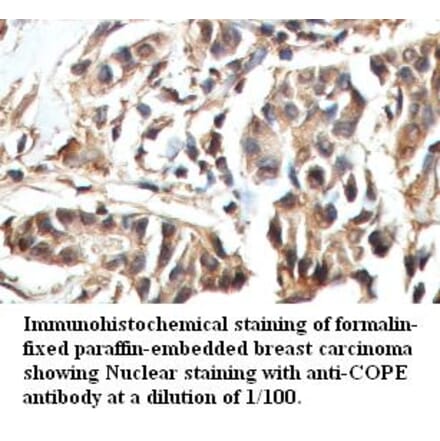 COPE Antibody from Signalway Antibody (39423) - Antibodies.com