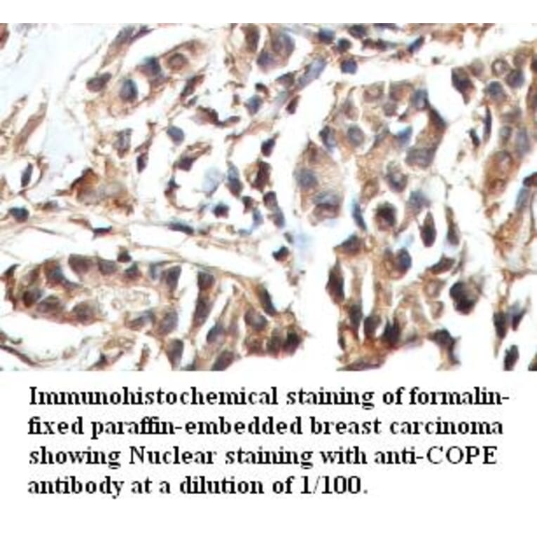 COPE Antibody from Signalway Antibody (39423) - Antibodies.com