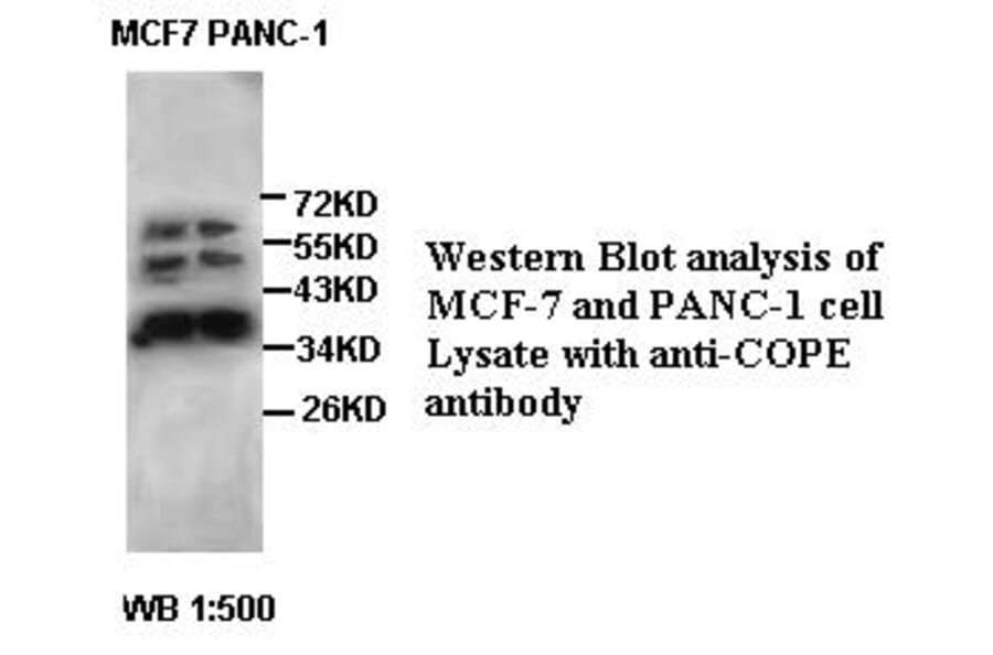 COPE Antibody from Signalway Antibody (39423) - Antibodies.com