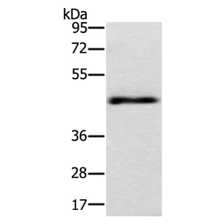 TWF1 Antibody from Signalway Antibody (40064) - Antibodies.com