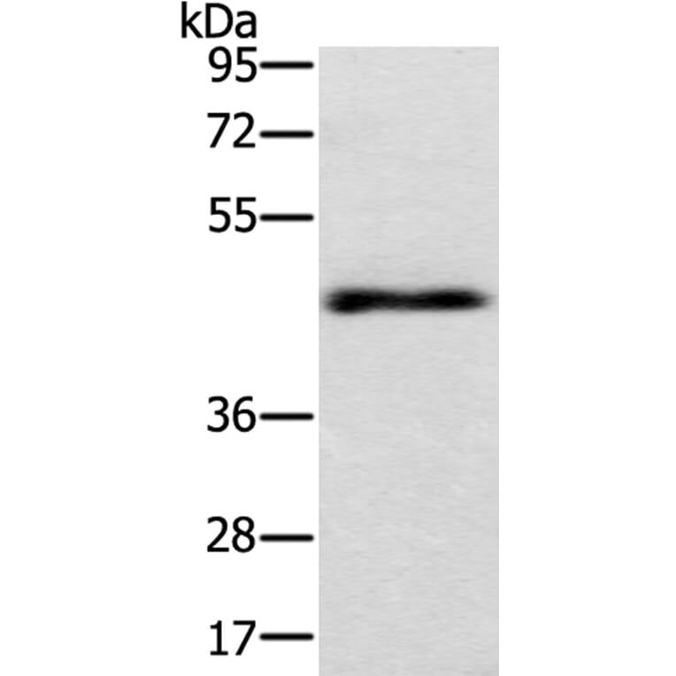 TWF1 Antibody from Signalway Antibody (40064) - Antibodies.com
