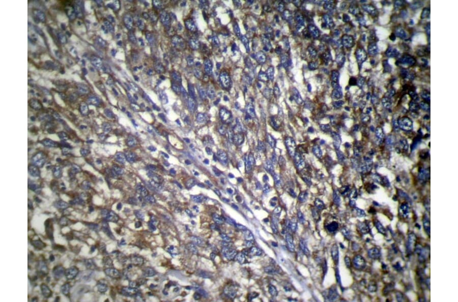 Immunohistochemistry - TWF1 Antibody from Signalway Antibody (40064) - Antibodies.com