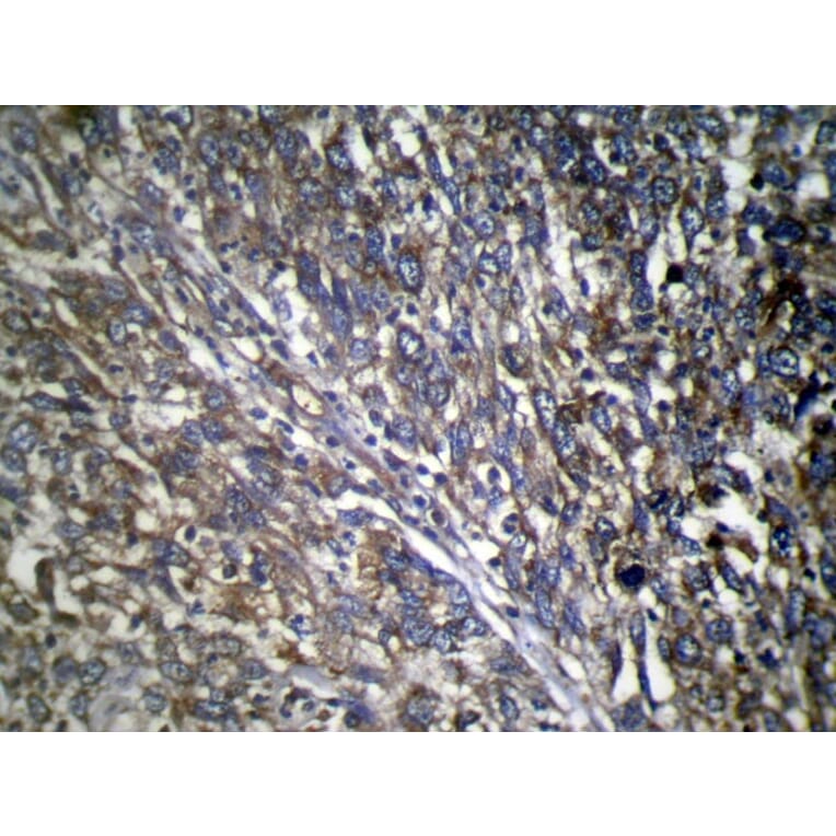 Immunohistochemistry - TWF1 Antibody from Signalway Antibody (40064) - Antibodies.com