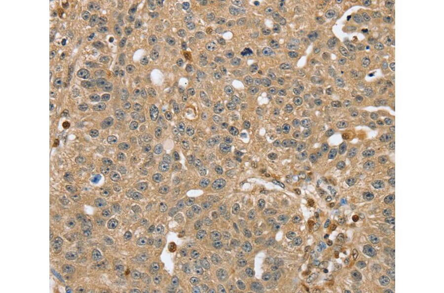 Immunohistochemistry - RNH1 Antibody from Signalway Antibody (40076) - Antibodies.com