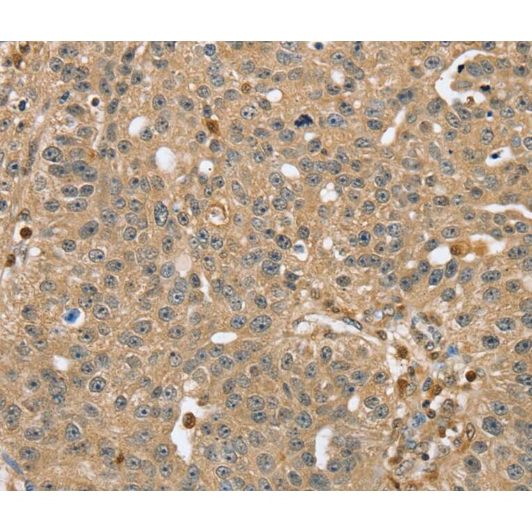Immunohistochemistry - RNH1 Antibody from Signalway Antibody (40076) - Antibodies.com