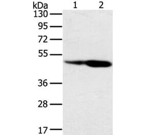 SNX8 Antibody from Signalway Antibody (40114) - Antibodies.com