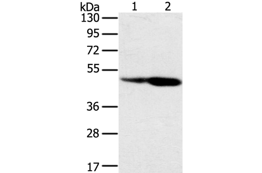 SNX8 Antibody from Signalway Antibody (40114) - Antibodies.com