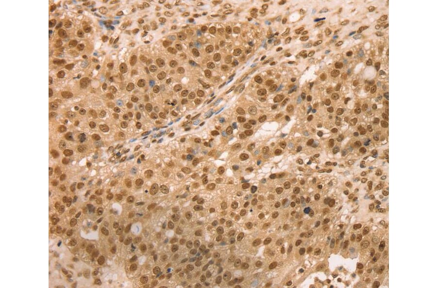 Immunohistochemistry - SNX8 Antibody from Signalway Antibody (40114) - Antibodies.com