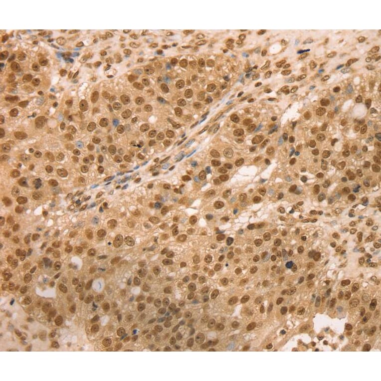 Immunohistochemistry - SNX8 Antibody from Signalway Antibody (40114) - Antibodies.com