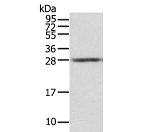 STX8 Antibody from Signalway Antibody (40127) - Antibodies.com