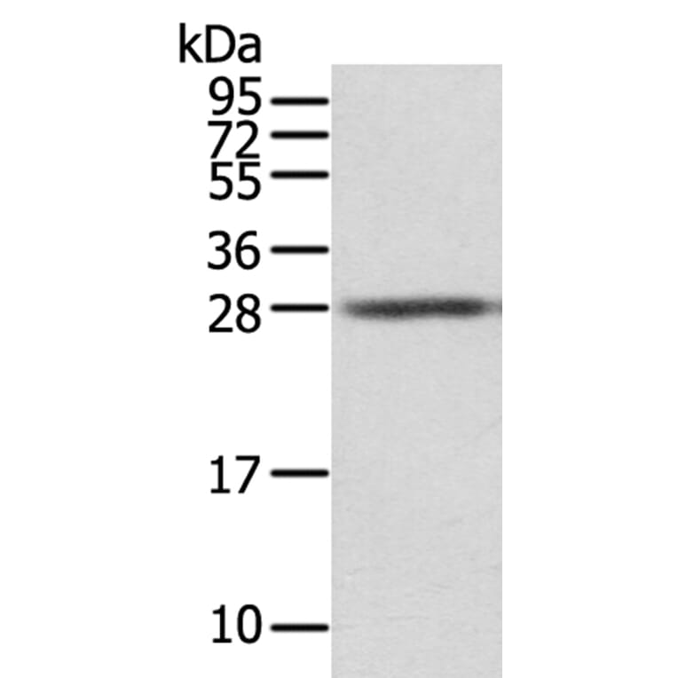 STX8 Antibody from Signalway Antibody (40127) - Antibodies.com