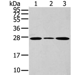 CD63 Antibody from Signalway Antibody (40192) - Antibodies.com