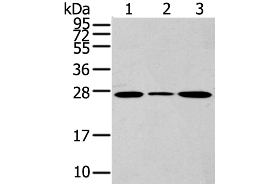 CD63 Antibody from Signalway Antibody (40192) - Antibodies.com
