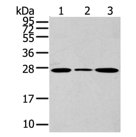 CD63 Antibody from Signalway Antibody (40192) - Antibodies.com