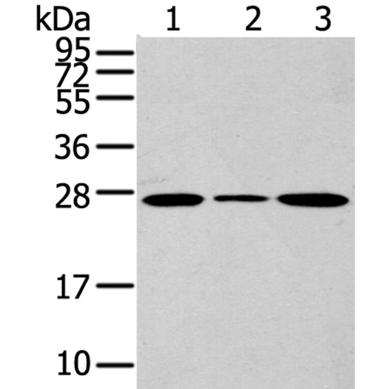 CD63 Antibody from Signalway Antibody (40192) - Antibodies.com