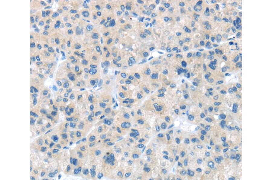 Immunohistochemistry - CD63 Antibody from Signalway Antibody (40192) - Antibodies.com