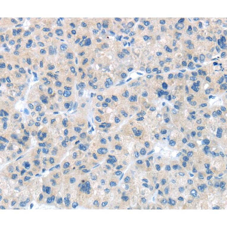 Immunohistochemistry - CD63 Antibody from Signalway Antibody (40192) - Antibodies.com
