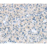 Immunohistochemistry - CD63 Antibody from Signalway Antibody (40192) - Antibodies.com