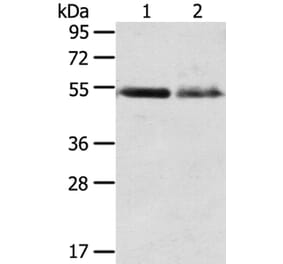 RHCG Antibody from Signalway Antibody (40211) - Antibodies.com