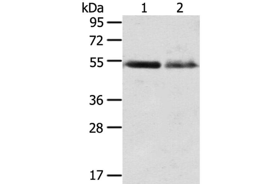RHCG Antibody from Signalway Antibody (40211) - Antibodies.com