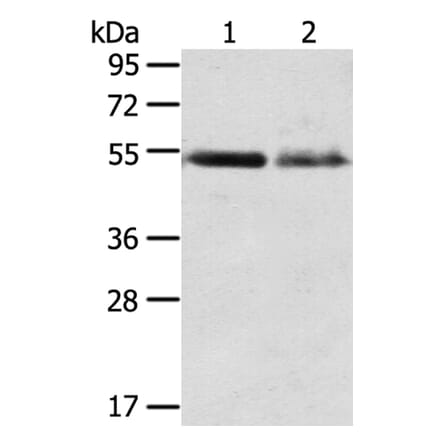 RHCG Antibody from Signalway Antibody (40211) - Antibodies.com