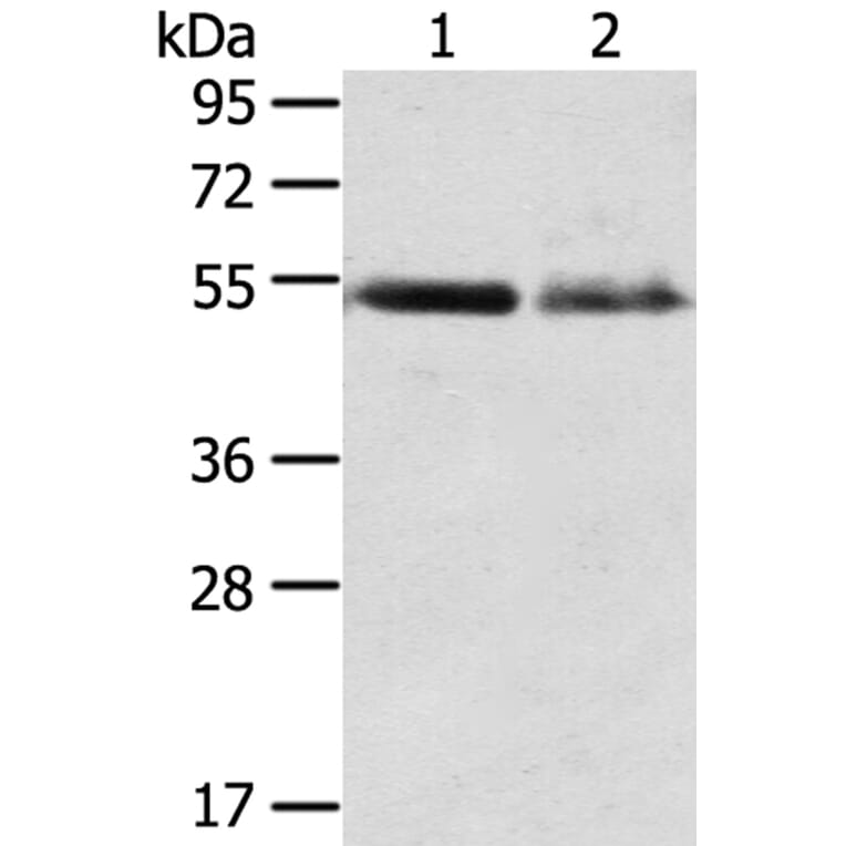 RHCG Antibody from Signalway Antibody (40211) - Antibodies.com